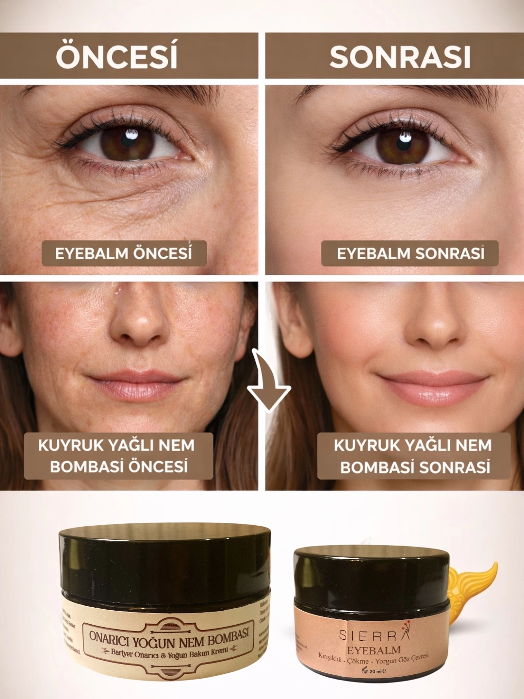 Onarıcı Nem & Göz Çevresi Bakımı – Kuyruk Yağlı Krem ve Eye Balm